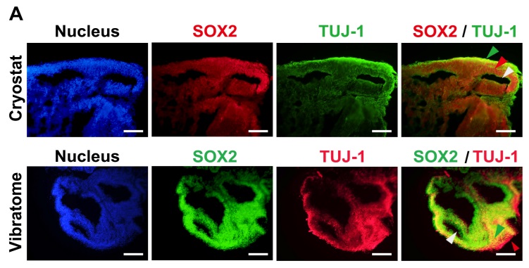 Vibratome Organoid Slicing